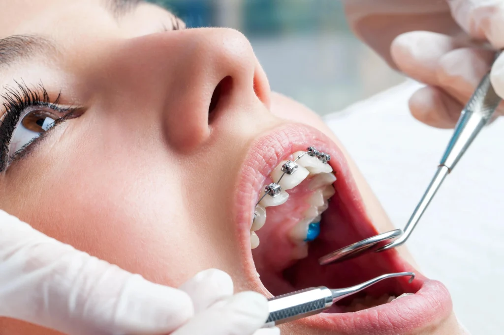 Pediatric Orthodontic in Lihue