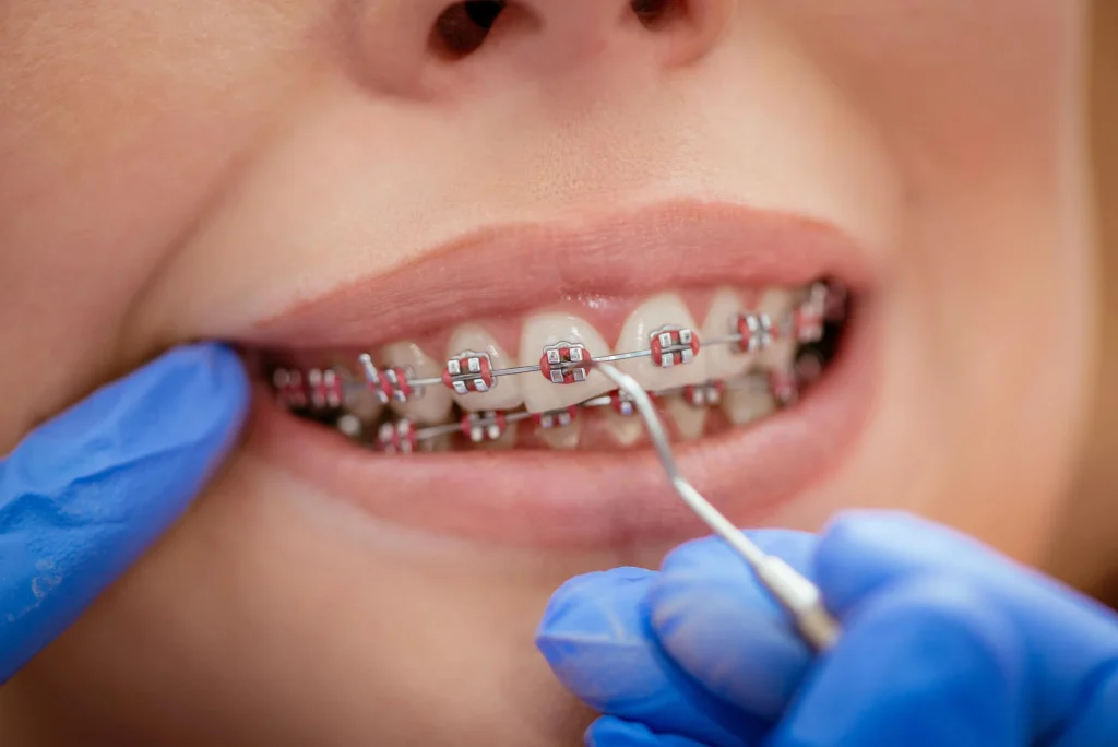 Orthodontist in Pearl City Conducting Adjustments